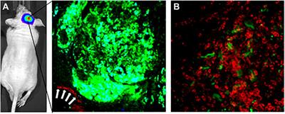 Integrating Nanotechnology in Neurosurgery, Neuroradiology, and Neuro-Oncology Practice—The Clinicians’ Perspective